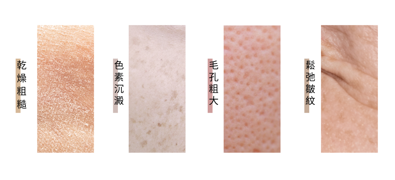 Các vấn đề về da